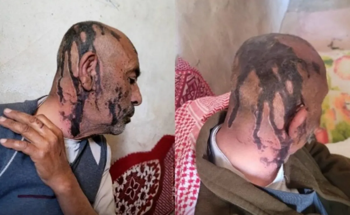 مسلحان من أنصار الله يعتديان بوحشية على والدهما المُسن في عمران