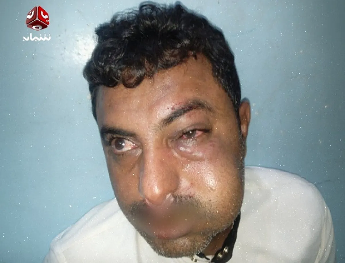 قيادي حوثي يعتدي على محامٍ في الحديدة