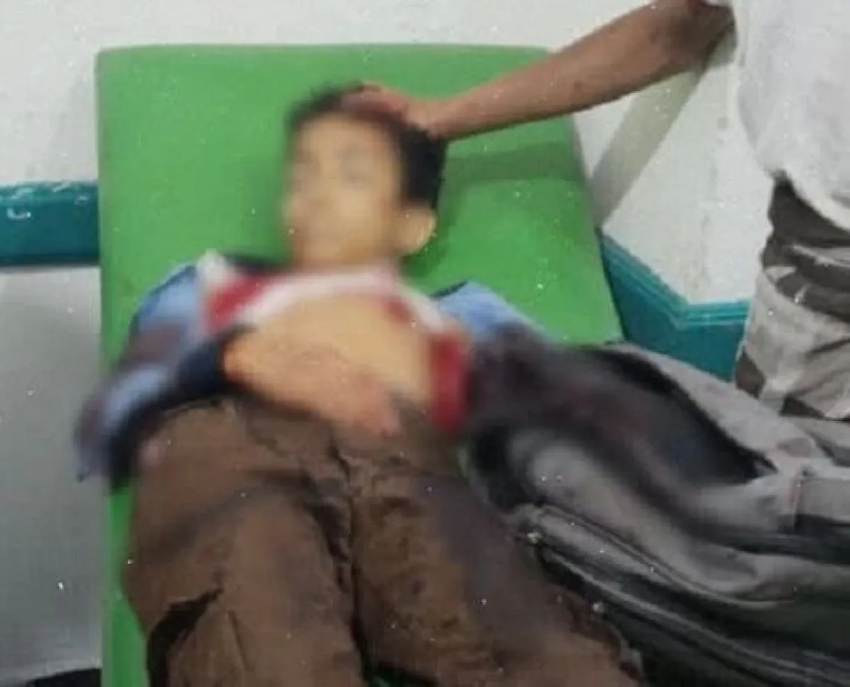 مقتل طفل برصاص قناص قوات صنعاء في تعز