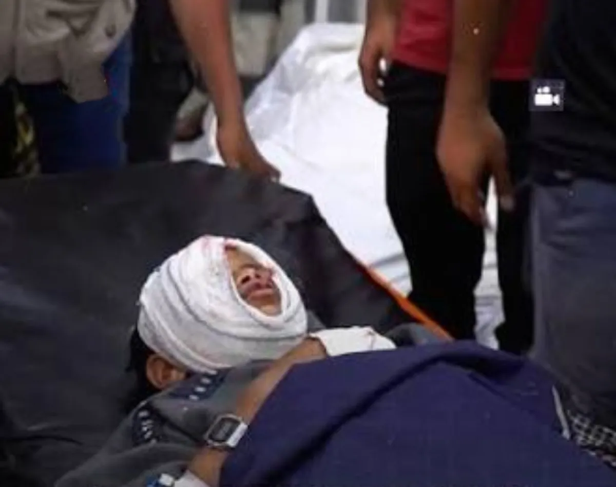 إصابة طفل بانفجار مقذوف من مخلفات الحوثيين في تعز