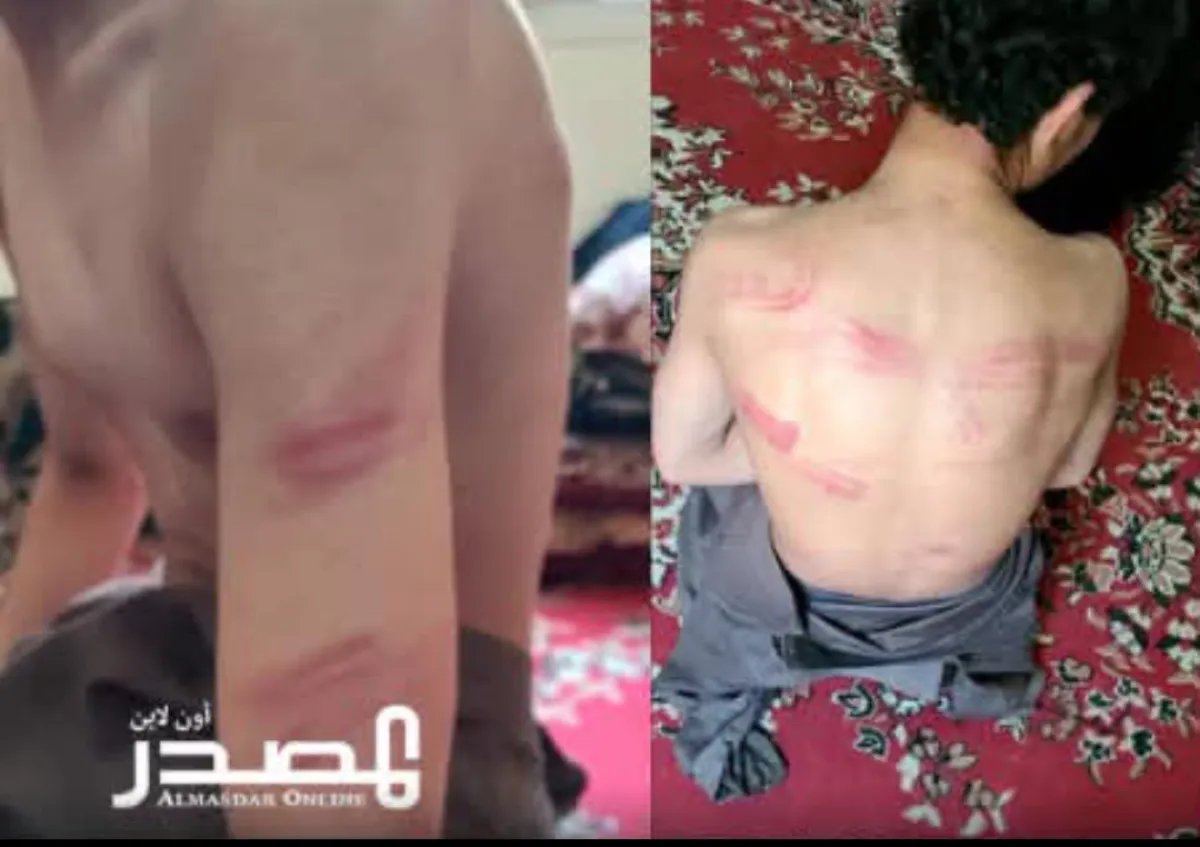 عناصر تابعة لأنصار الله تعتقل طفلاً وتعرضه للتعذيب داخل سجن في ضحيان بصعدة