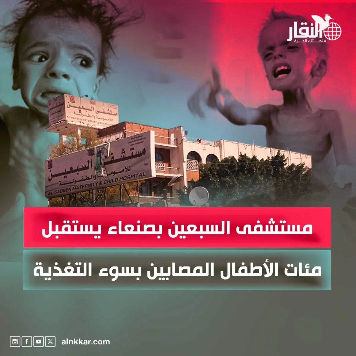 مستشفى السبعين بصنعاء يستقبل مئات الأطفال المصابين بسوء التغذية