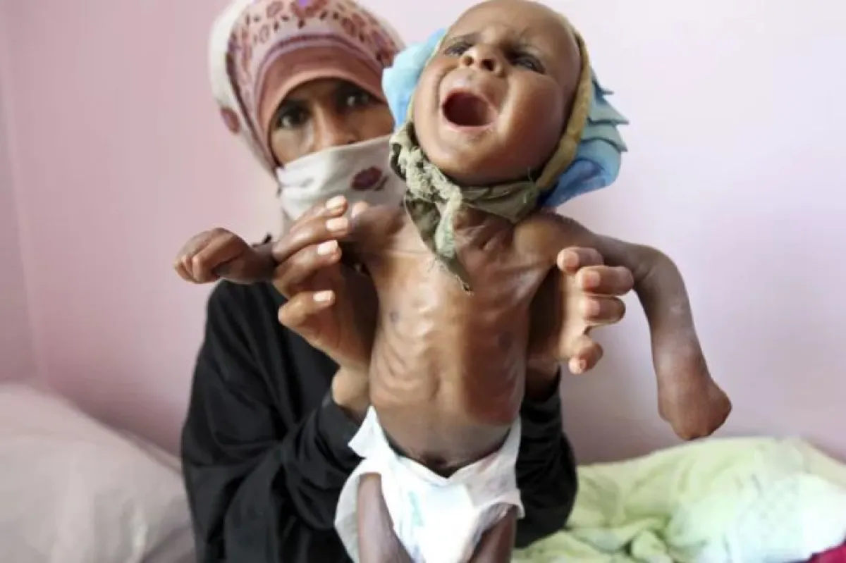 تقرير أممي يحذر من تفاقم أزمة الغذاء في مناطق سيطرة الحوثيين