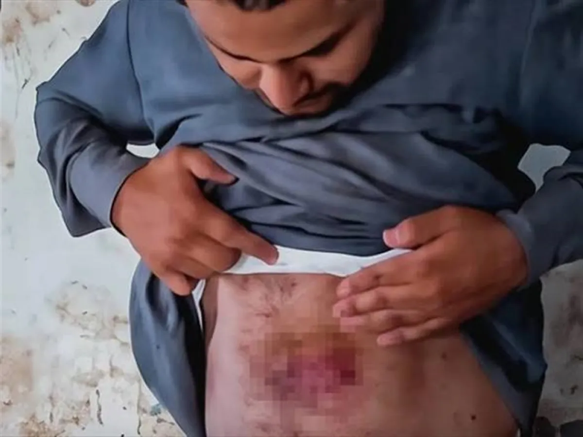 أسرة الفراشي تتهم الحوثيين بتعذيبه داخل سجن في صعدة