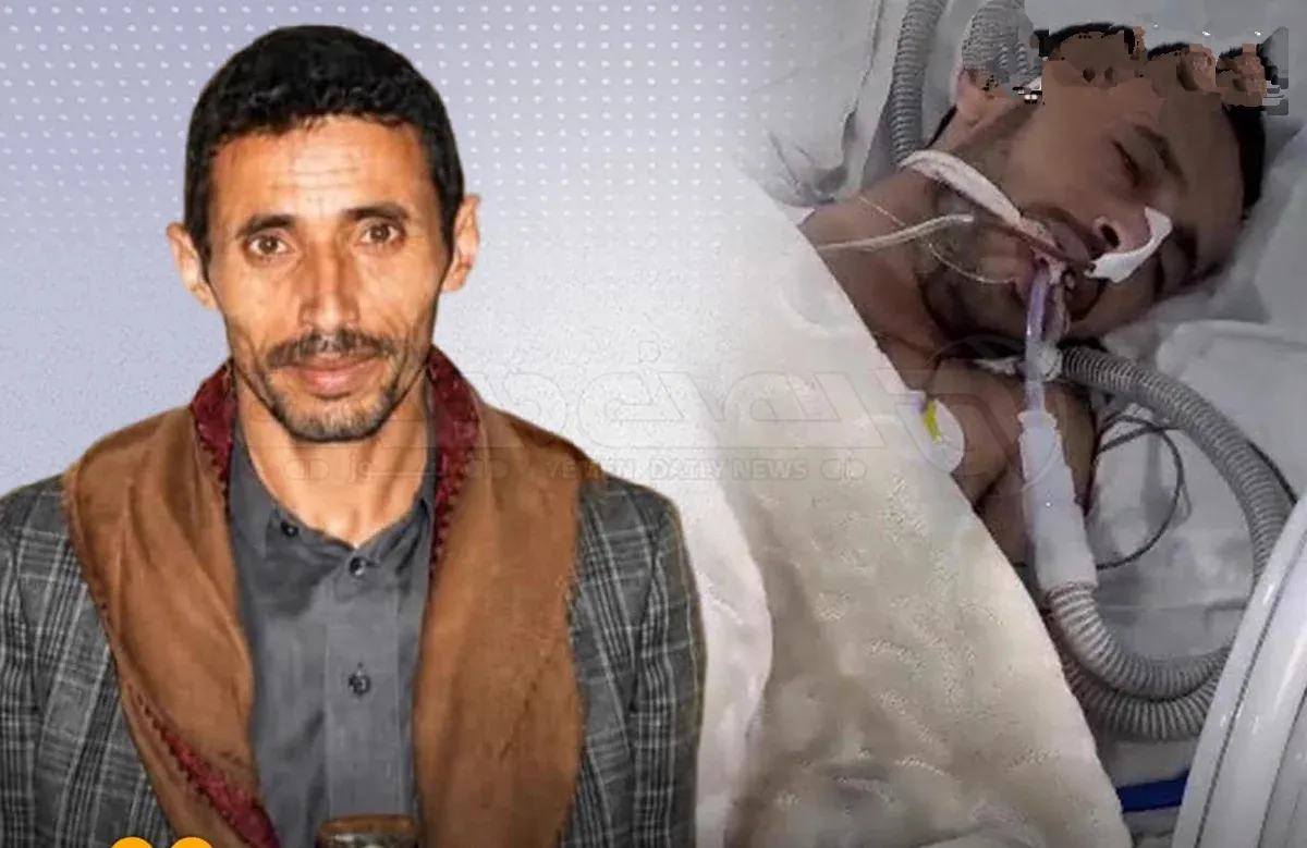 وفاة مواطن بعد أيام من الإفراج عنه من سجن تابع للحوثيين في صنعاء