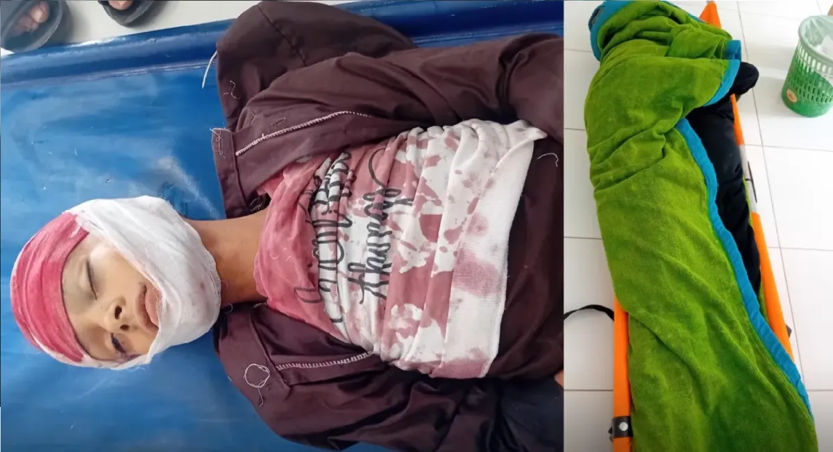 الأمم المتحدة: 225 قتيلاً وجريحاً مدنياً جراء تصاعد النزاع في اليمن