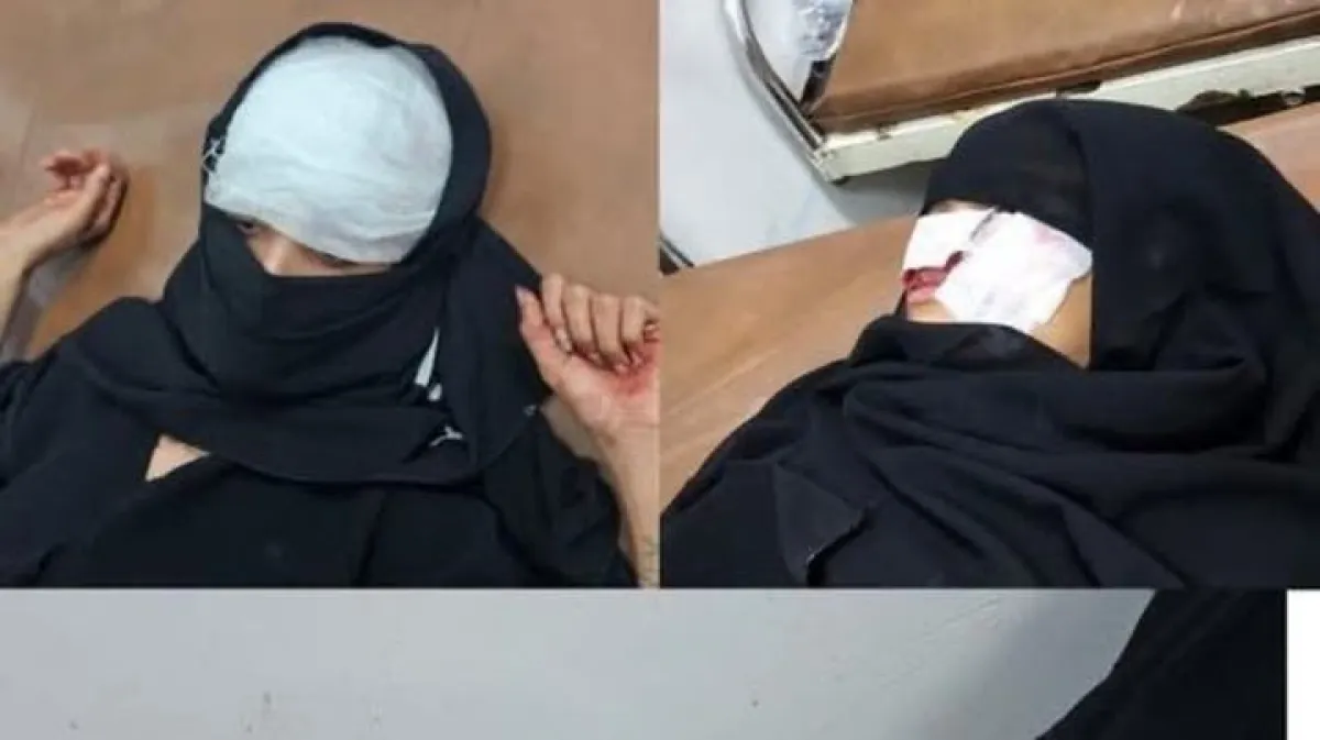 مقتل وإصابة 5 مدنيين بينهم طفلان وتضرر 11 منزلاً بقصف للحوثيين جنوبي تعز