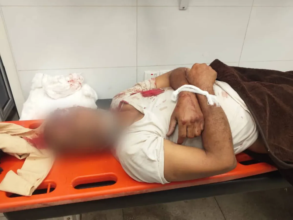 الأمم المتحدة: 270 ضحية مدنية في اليمن منذ مطلع أغسطس